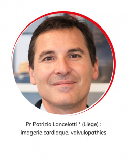 Pr Patrizio Lancelotti * (Liège) : imagerie cardiaque, valvulopathies