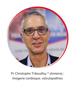 r Christophe Tribouilloy * (Amiens) : imagerie cardiaque, valvulopathies